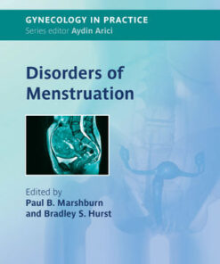 Disorders of Menstruation eBook