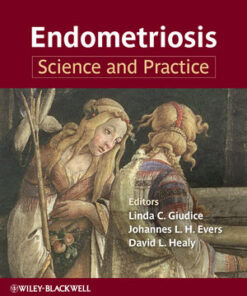 Endometriosis: Science and Practice eBook