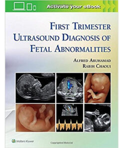 First Trimester Ultrasound Diagnosis of Fetal Abnormalities eBook