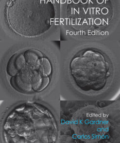 Handbook of In Vitro Fertilization eBook