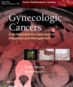 Gynecologic Cancers: A Multidisciplinary Approach to Diagnosis and Management eBook