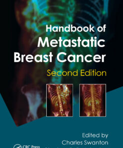 Handbook of Metastatic Breast Cancer eBook