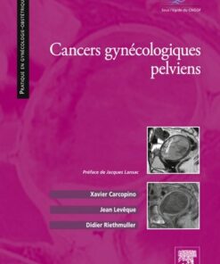 Cancers gynécologiques pelviens eBook
