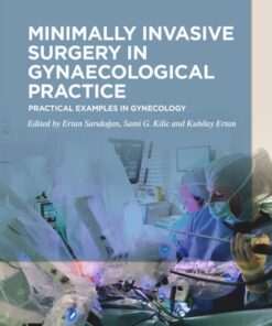 Minimally Invasive Surgery in Gynecological: Practice Practical Examples in Gynecology eBook