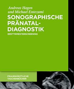 Sonographische Pränataldiagnostik: Ersttrimesterscreening eBook