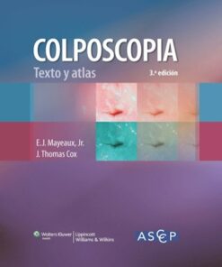 Colposcopia. Texto y atlas eBook