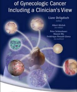 Early Pathologic Diagnosis of Gynecologic Cancer Including a Clinician's View eBook