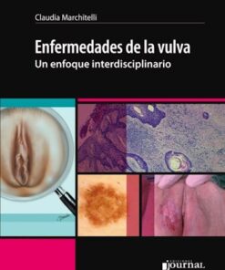 Enfermedades de la vulva eBook
