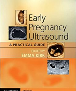 Early Pregnancy Ultrasound: A Practical Guide eBook