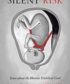 Silent Risk: Issues About the Human Umbilical Cord (Second Edition) eBook