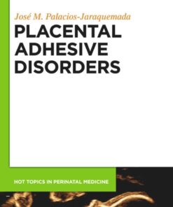 Placental Adhesive Disorders eBook