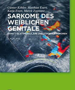 Glattmuskuläre und stromale Tumoren eBook