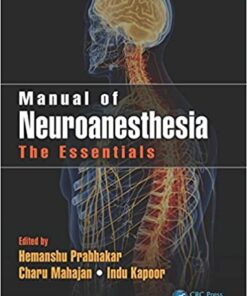 Manual of Neuroanesthesia: The Essentials eBook