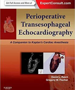 Perioperative Transesophageal Echocardiography: A Companion to Kaplan’s Cardiac Anesthesia (Expert Consult: Online) eBook