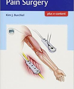 Handbook of Pain Surgery eBook
