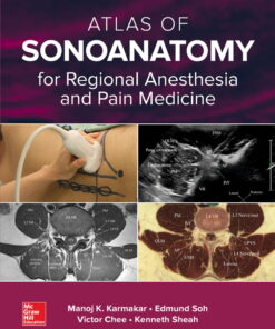 Atlas of Sonoanatomy for Regional Anesthesia and Pain Medicine eBook