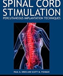 Spinal Cord Stimulation: Percutaneous Implantation Techniques eBook