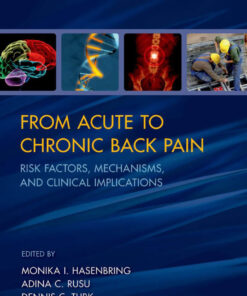 From Acute to Chronic Back Pain: Risk Factors, Mechanisms, and Clinical Implications eBook