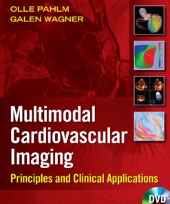 Multimodal Cardiovascular Imaging eBook