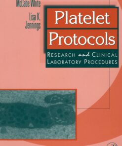Platelet Protocols: Research and Clinical Laboratory Procedures eBook