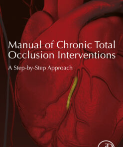 Manual of Chronic Total Occlusion Interventions: A Step-by-Step Approach eBook