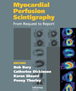 Myocardial Perfusion Scintigraphy: From Request to Report eBook