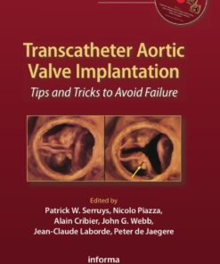 Transcatheter Aortic Valve Implantation: Tips and Tricks to Avoid Failure eBook