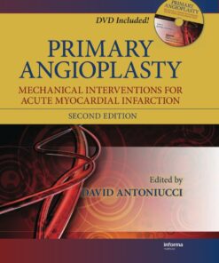 Primary Angioplasty: Mechanical Interventions for Acute Myocardial Infarction, Second Edition eBook