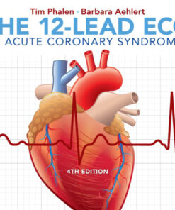 The 12-Lead ECG in Acute Coronary Syndromes eBook