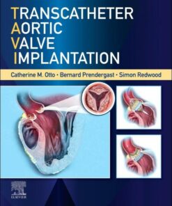 Transcatheter Aortic Valve Implantation eBook