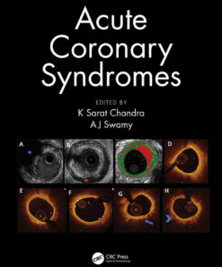 Acute Coronary Syndromes eBook