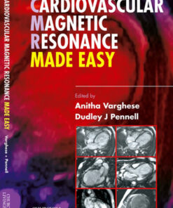 Cardiovascular Magnetic Resonance Made Easy eBook