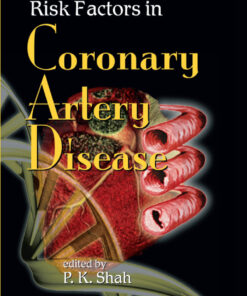 Risk Factors in Coronary Artery Disease eBook
