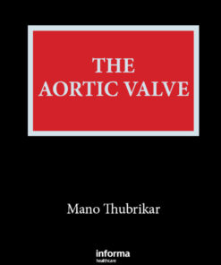 The Aortic Valve eBook