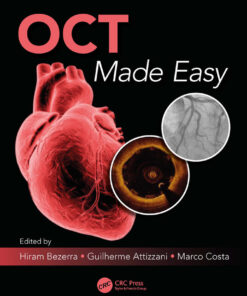 OCT Made Easy eBook