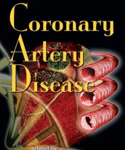 Risk Factors in Coronary Artery Disease eBook