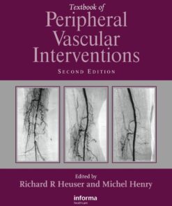 Textbook of Peripheral Vascular Interventions eBook