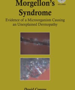 Morgellon's Syndrome eBook
