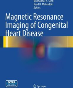 Magnetic Resonance Imaging of Congenital Heart Disease eBook