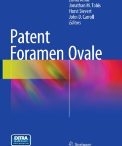 Patent Foramen Ovale eBook