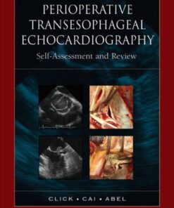 Perioperative Transesophageal Echocardiography Self-Assessment and Review eBook