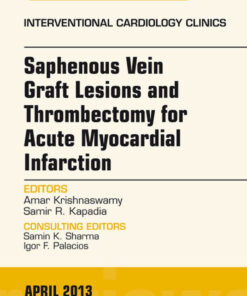 Saphenous Vein Graft Lesions and Thrombectomy for Acute Myocardial Infarction, An Issue of Interventional Cardiology Clinics eBook