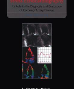 Stress Echocardiography: Its Role in the Diagnosis and Evaluation of Coronary Artery Disease eBook