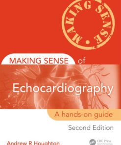 Making Sense of Echocardiography: A Hands-on Guide, Second Edition eBook
