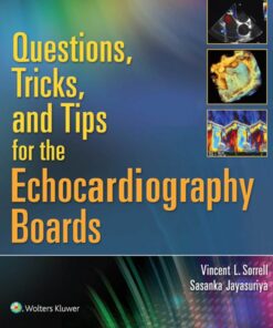 Questions, Tricks, and Tips for the Echocardiography Boards eBook