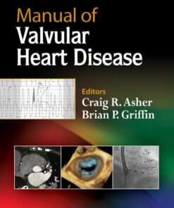 Manual of Valvular Heart Disease eBook