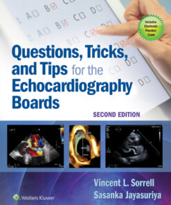 Questions, Tricks, and Tips for the Echocardiography Boards eBook