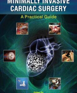 Minimally Invasive Cardiac Surgery: A Practical Guide eBook