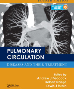 Pulmonary Circulation: Diseases and Their Treatment, Fourth Edition eBook