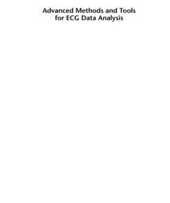 Advanced Methods and Tools for ECG Data Analysis eBook